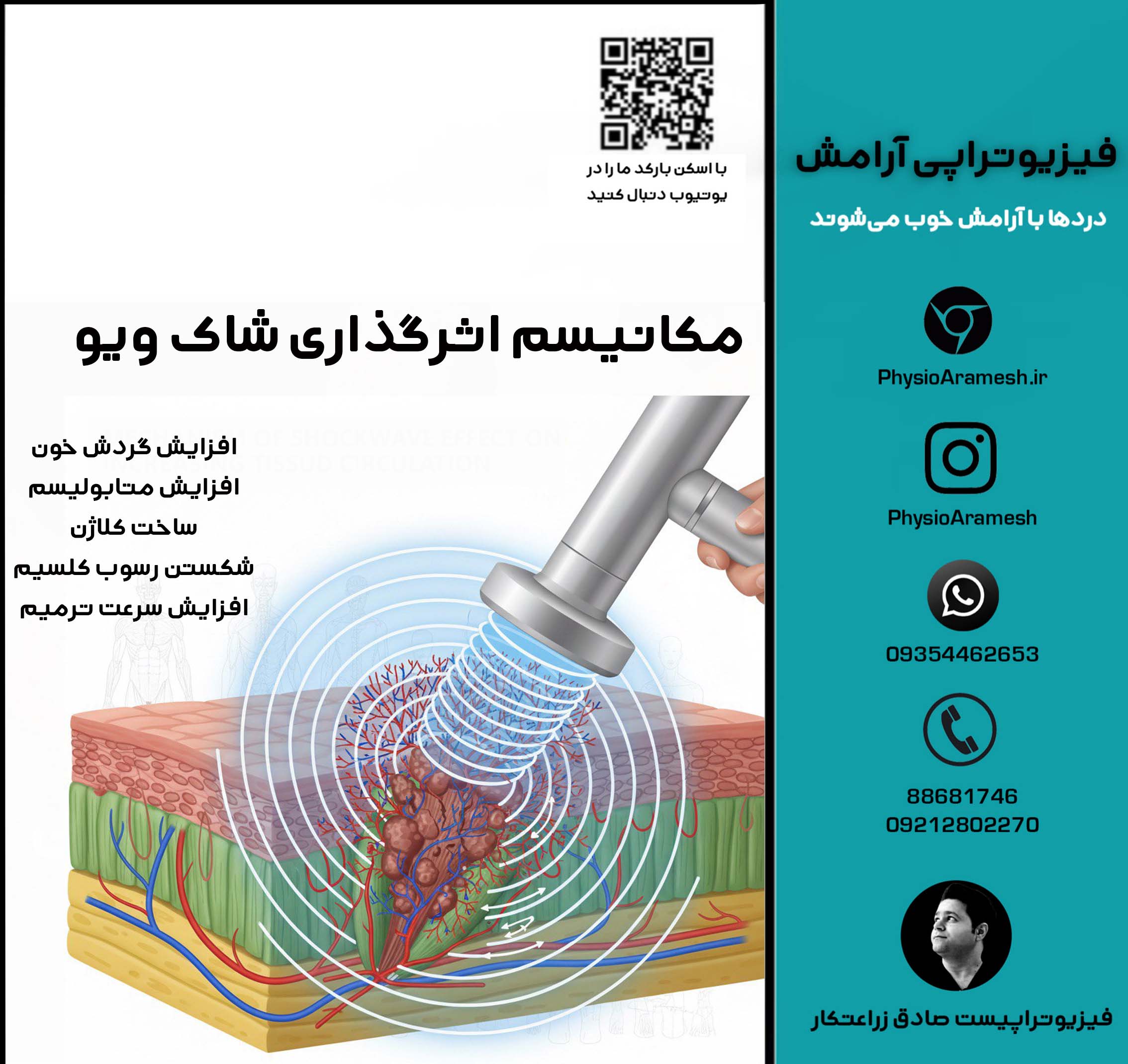 مکانیسم اثرگذاری شاک ویو